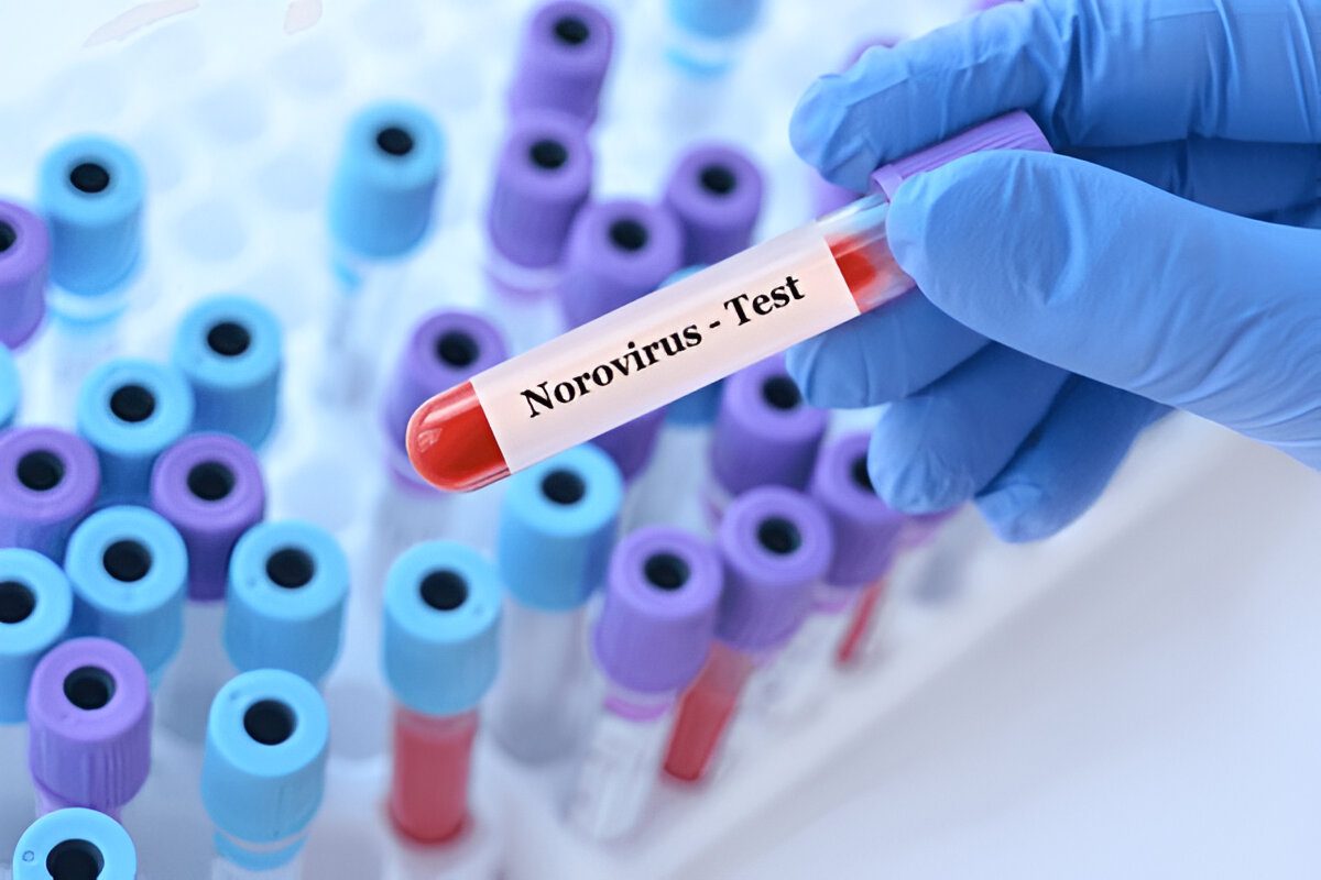 Norovirus symptoms chart showing common signs of the illness.